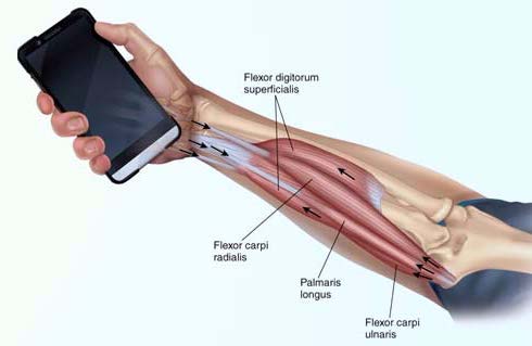 inside smartphoneinjury1